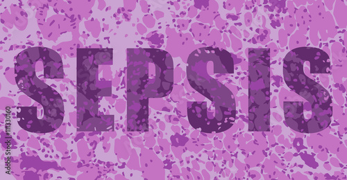 sepsis tissue view