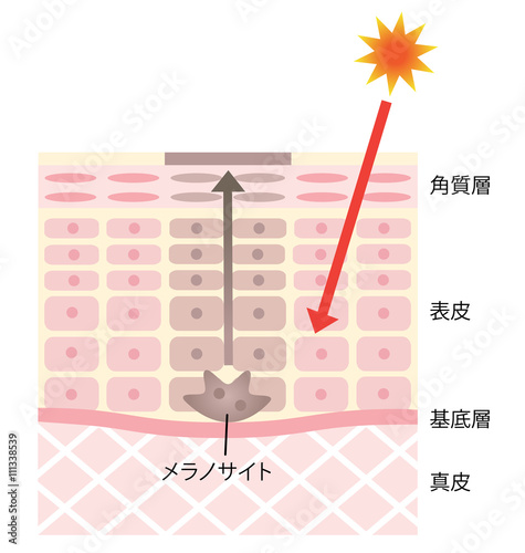 しみ肌の構造