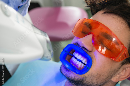 Teeth whitening. Procedure with high powered lamp