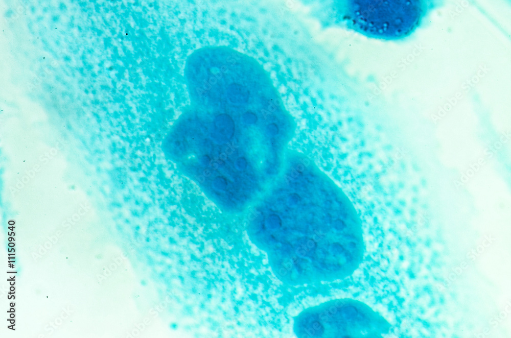 PC-3 human prostate cancer cells