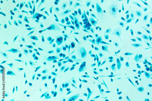 Foto PC-3 human prostate cancer cells