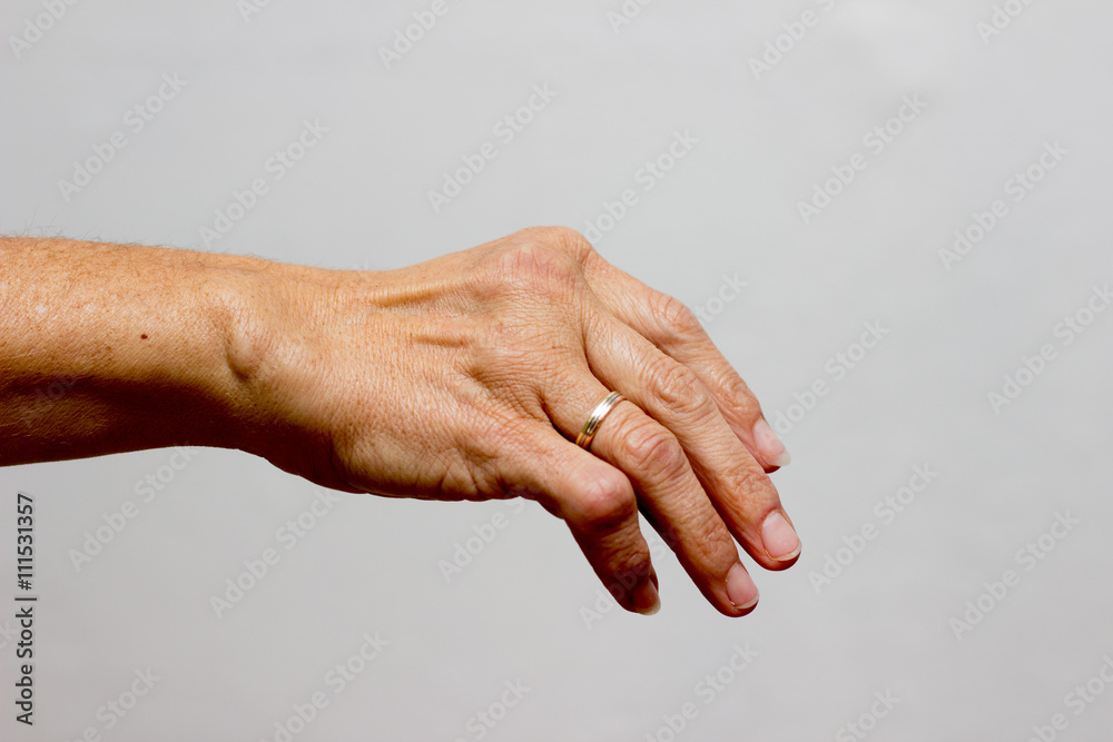 Fototapeta premium Rheuma