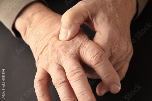 Joint pain on hand of older ma