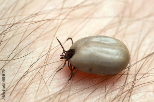 Castor bean tick, Ixodes ricinus, carrier of diseases like tbe and borreliosis filled with blood crawling on human skin photo