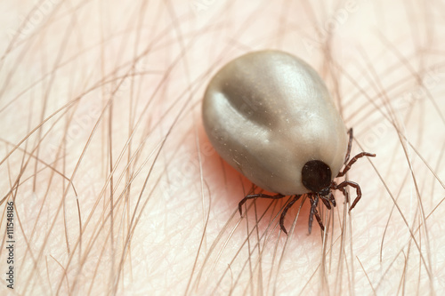 Castor bean tick, Ixodes ricinus, carrier of diseases like tbe and borreliosis filled with blood crawling on human skin photo