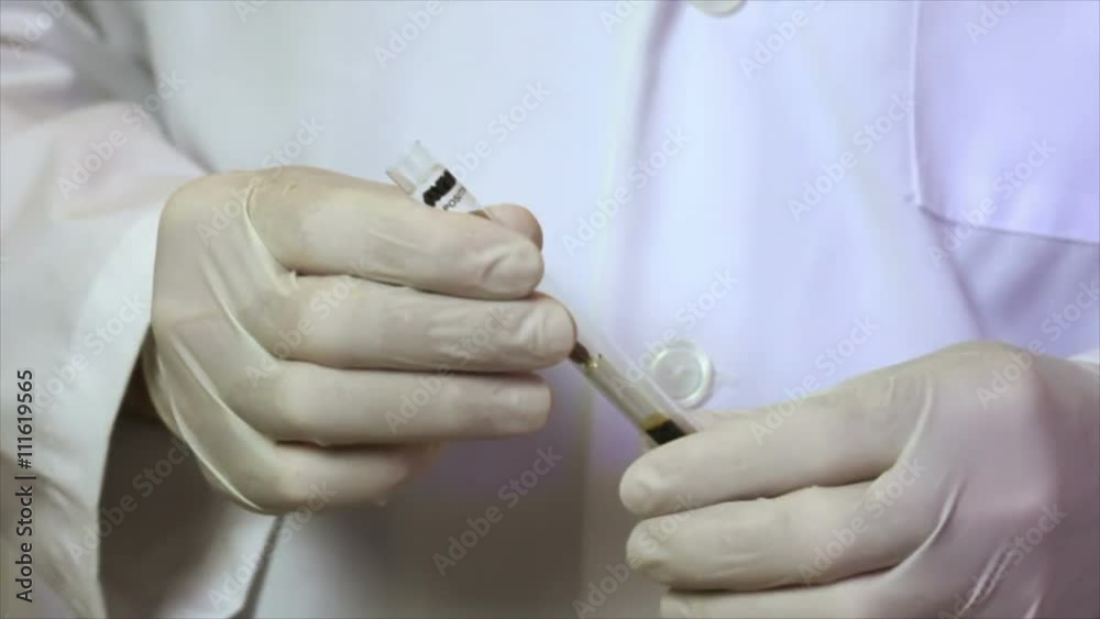A laboratory technician or CSI investigator using a method to determine if blood is present on a swab sample observes the chemical reaction. A laboratory technician or CSI investigator using a method to determine if blood is present on a swab sample observes the chemical reaction.