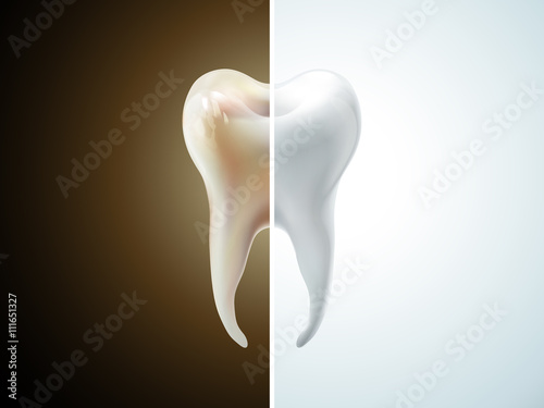 comparison of tooth