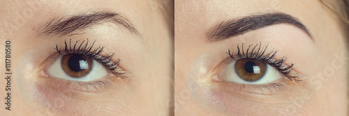 Perfect Eyebrows Before After