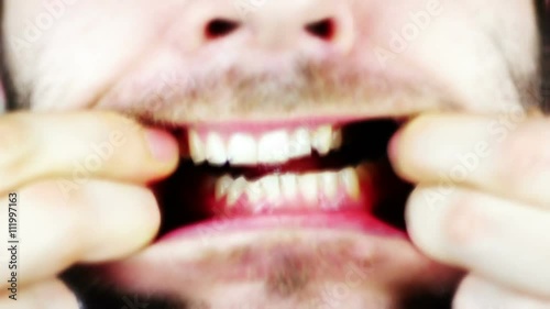 SUPER 35MM CAMERA - Disgusting man making awful faces with his jaw