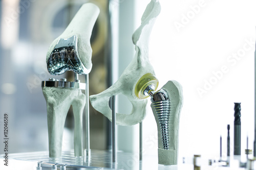 Modern knee and hip prosthesis made by cad engineer and manufactured by 3d printing photo