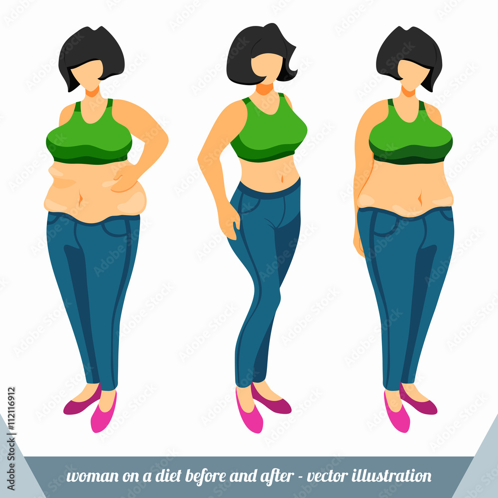 Female obesity. The woman before and after weight loss. Flab on belly ...
