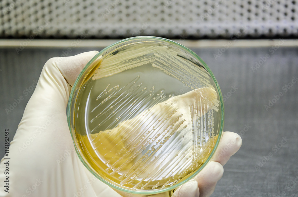 Hand in glove is holding a petri dish of cross streak of Saccharomyces cerevisiae (baker yeast