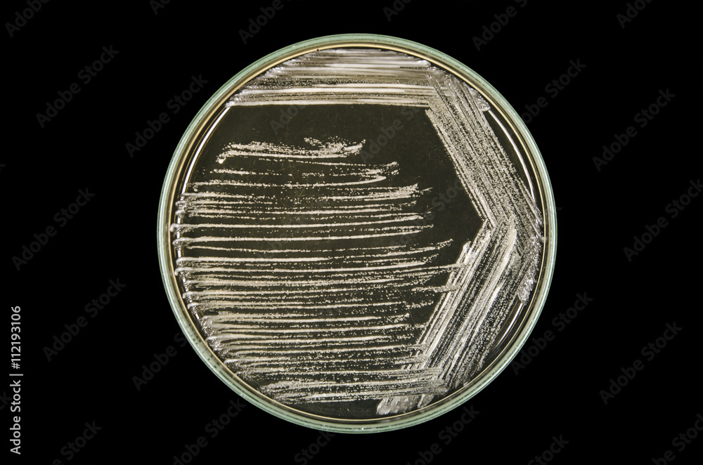 Cross streak of Saccharomyces cerevisiae (baker yeast) growing on yeast extract peptone dextrose