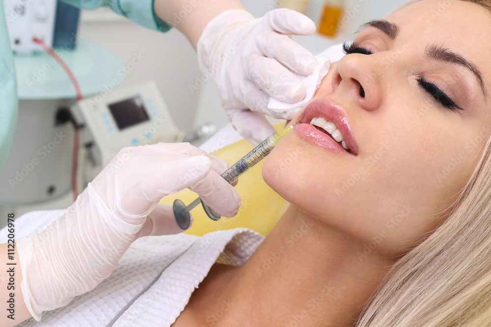 Injection in her lips. Injection in her lips.