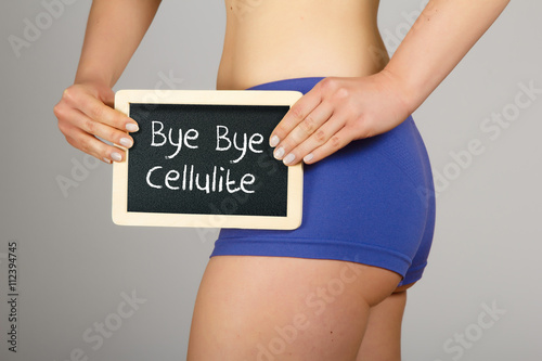 Cellulite treatment concept. Beautiful young woman in lingerie holding a small chalk board with text 