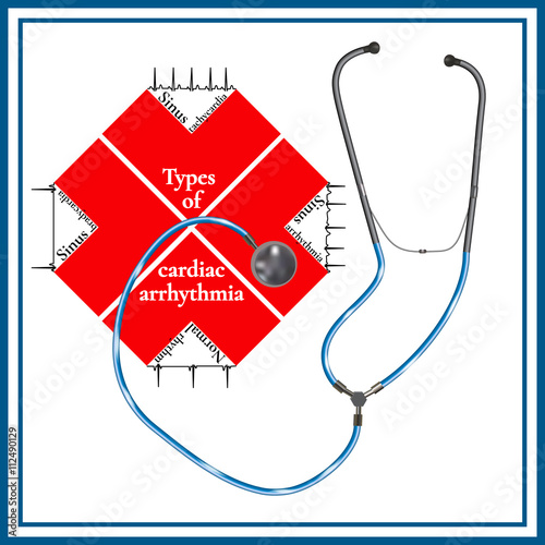 Types of cardiac arrhythmia: sinus tachycardia, sinus arrhythmia, sinus bradycardia, normal rhythm. Cardiogram. Phonendoscopes.