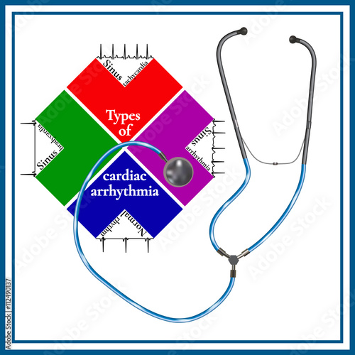 Types of cardiac arrhythmia: sinus tachycardia, sinus arrhythmia, sinus bradycardia, normal rhythm. Cardiogram. Phonendoscopes.