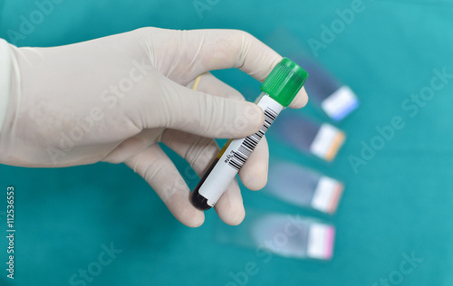 scientist hand holding laboratory test tube © toeytoey
