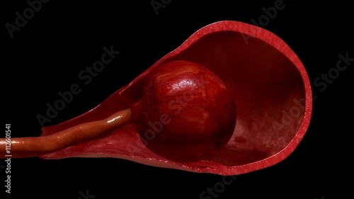 Labor and vaginal birth