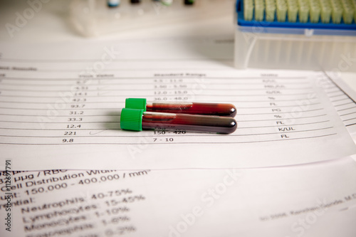 Photos Two test tubes with blood for analysis and research in medical research lab near