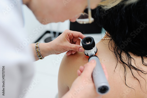 melanoma diagnosis. the doctor examines the patient's mole