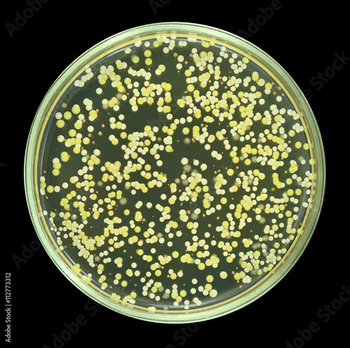 Colonies of bacteria from sea water on a petri dish ( agar ) isolated on black background.  At least four different colors bacterial species are presented. Focus on full depth.
