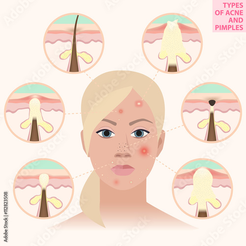 Distressed leather woman, vector illustration