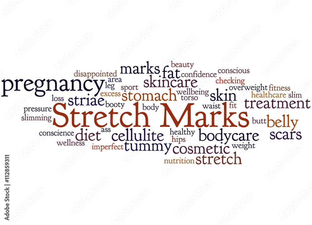 Stretch Marks, word cloud concept 2 Stretch Marks, word cloud concept 2