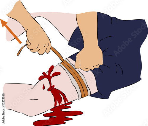 First help - stop blood on leg with rubber band