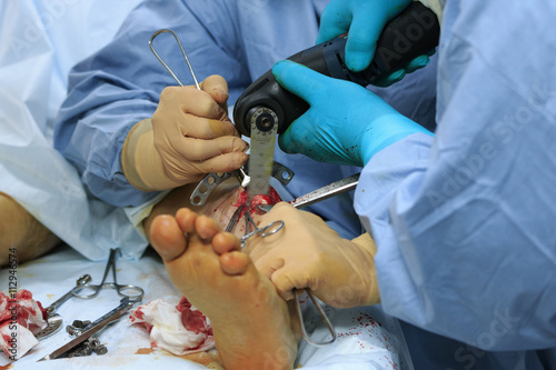 Canvas Print Surgeon cut the shin with special orthopedic saw during the surgery