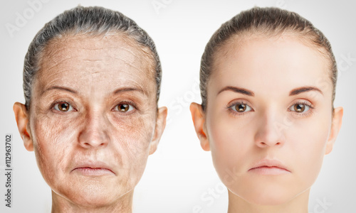 Aging process, rejuvenation anti-aging skin procedures old and young concept photo