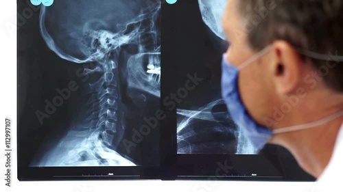 Doctor or nurse or health care specialist with face mask on points to an x-ray of the cranium and neck of a patient.