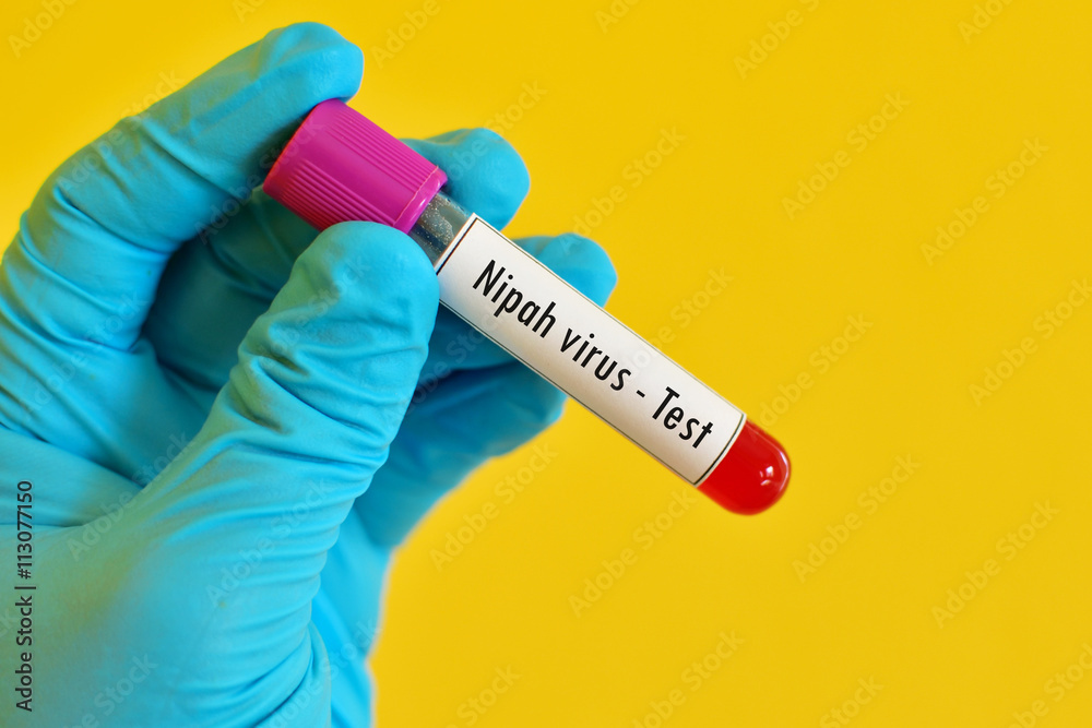 Fototapeta premium Blood for Nipah virus test 