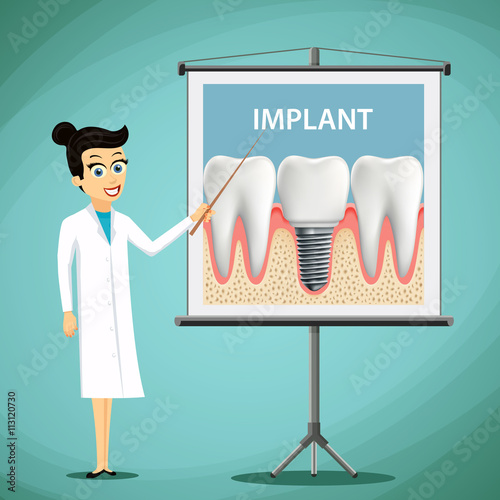 Woman dentist showing a poster with tooth implant. Dental treatm