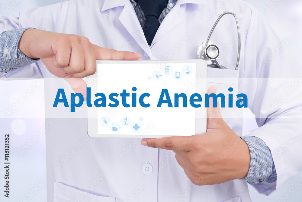 Aplastic Anemia Aplastic Anemia