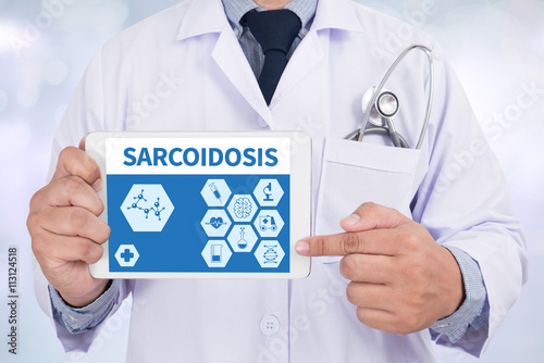 SARCOIDOSIS