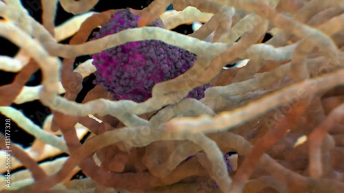Macrophage with bacterium photo