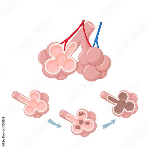 Human lungs alveoli