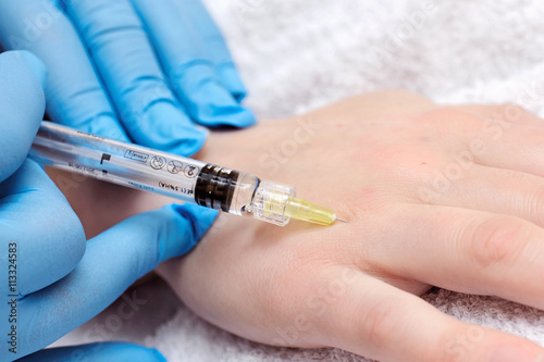 Anti-age injection therapy. Wrinkles reduction.