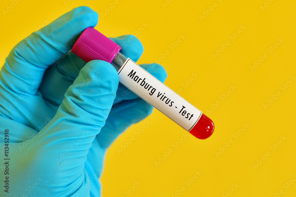 Fototapeta premium Test tube with blood sample for Marburg virus test 