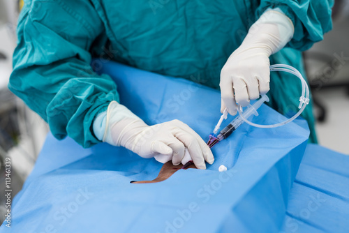 central venous pressure procedure