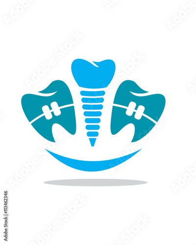 Orthodontics implant smile