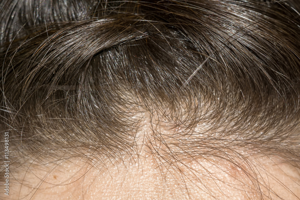Braided Hair Macro Braided Hair Macro