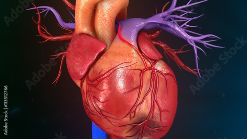 Cuadro en lienzo Myocardial Infarction