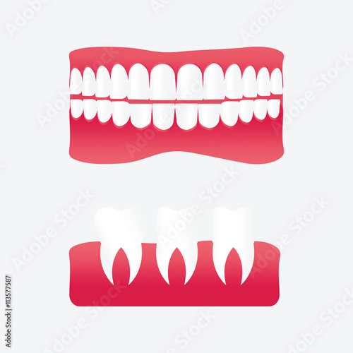 Vector cartoon false teeth