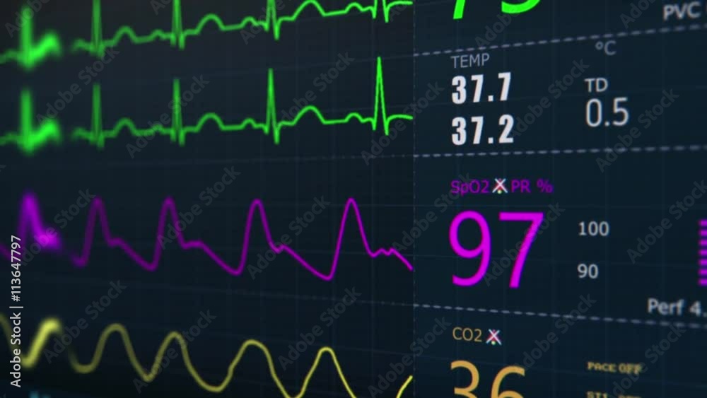 ICU monitor. ICU monitor.