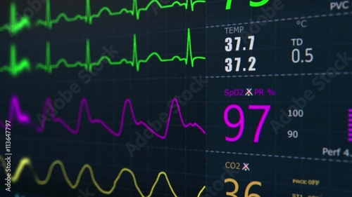 ICU monitor.