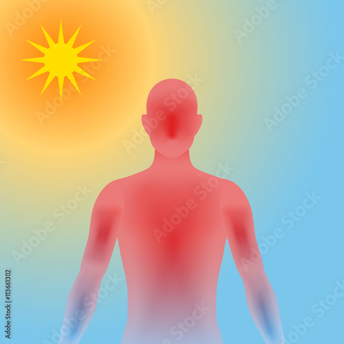 human heatstroke, thermic fever, thermoplegia, image illustration