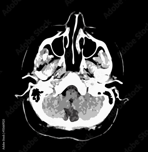 CT scan of brain, black and white vector graphic