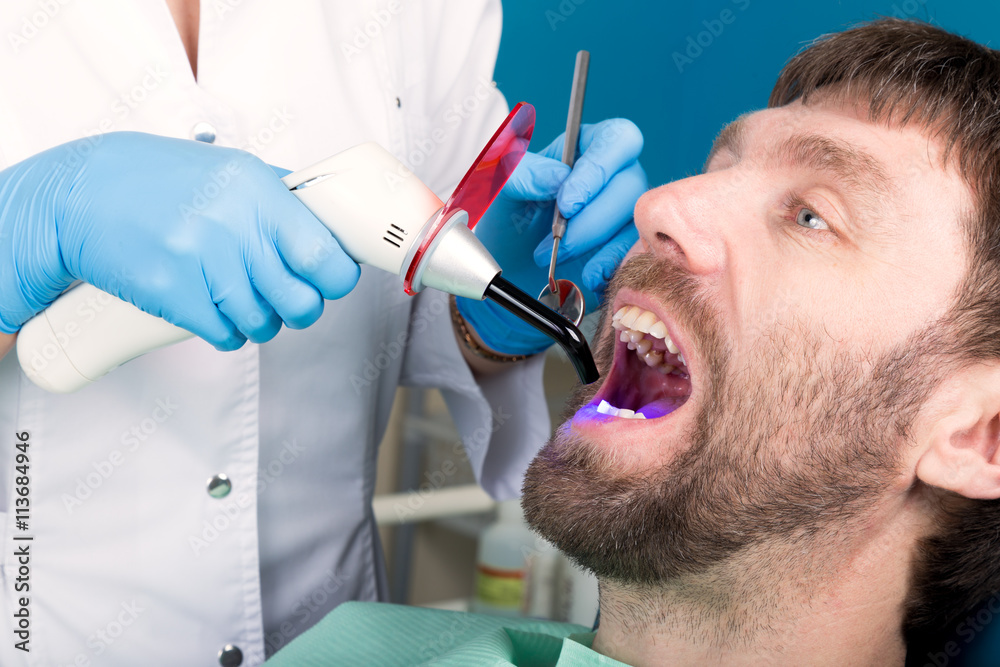 Doctor examines the oral cavity on tooth decay. Caries protection. Tooth decay treatment. Dentist working with dental polymerization lamp in oral cavity Doctor examines the oral cavity on tooth decay. Caries protection. Tooth decay treatment. Dentist working with dental polymerization lamp in oral cavity